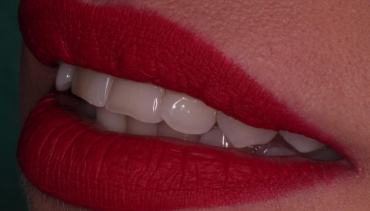 Cosmetica Dentara